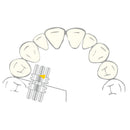 EXPANSION SCREW VECTOR 140/160 SCHEU 1pcs