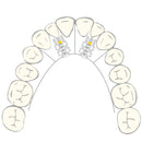 EXPANSION SCREW VECTOR 30 2pcs SCHEU
