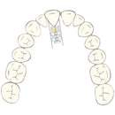 EXPANSION SCREW VECTOR 30 2pcs SCHEU