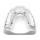 EXPANSION SCREW VECTOR 30 2pcs SCHEU