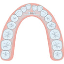 EXPANSION SCREW VECTOR 40 1pcs SCHEU