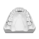 EXPANSION SCREW VECTOR 40 1pcs SCHEU