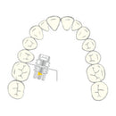 EXPANSION SCREW VECTOR 420 1pcs SCHEU