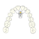 EXPANSION SCREW VECTOR 440R 1pcs SCHEU