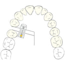 EXPANSION SCREW VECTOR 500/520 SCHEU 1pcs