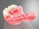 3D PRINTING RESIN FREEPRINT DENTURE