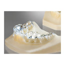 3D PRINTING RESIN FREEPRINT ORTHO 385nm & 405nm