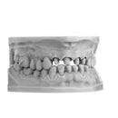 3D PRINTING RESIN IMPRIMO LC MODEL 385nm 1kg