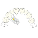 EXPANSION SCREW VECTOR 400 1pcs SCHEU