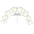 EXPANSION SCREW VECTOR 40 1pcs SCHEU