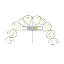 EXPANSION SCREW VECTOR 45 1pcs SCHEU