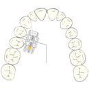 EXPANSION SCREW VECTOR 460 1pcs SCHEU