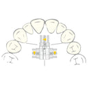 EXPANSION SCREW VECTOR 720 1pcs SCHEU