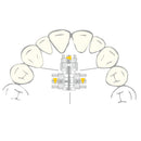 EXPANSION SCREW VECTOR 740 1pcs SCHEU