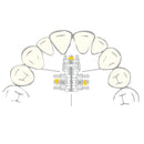 EXPANSION SCREW VECTOR 750 1pcs SCHEU