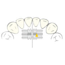 EXPANSION SCREW VECTOR 90/100 SCHEU 1pcs